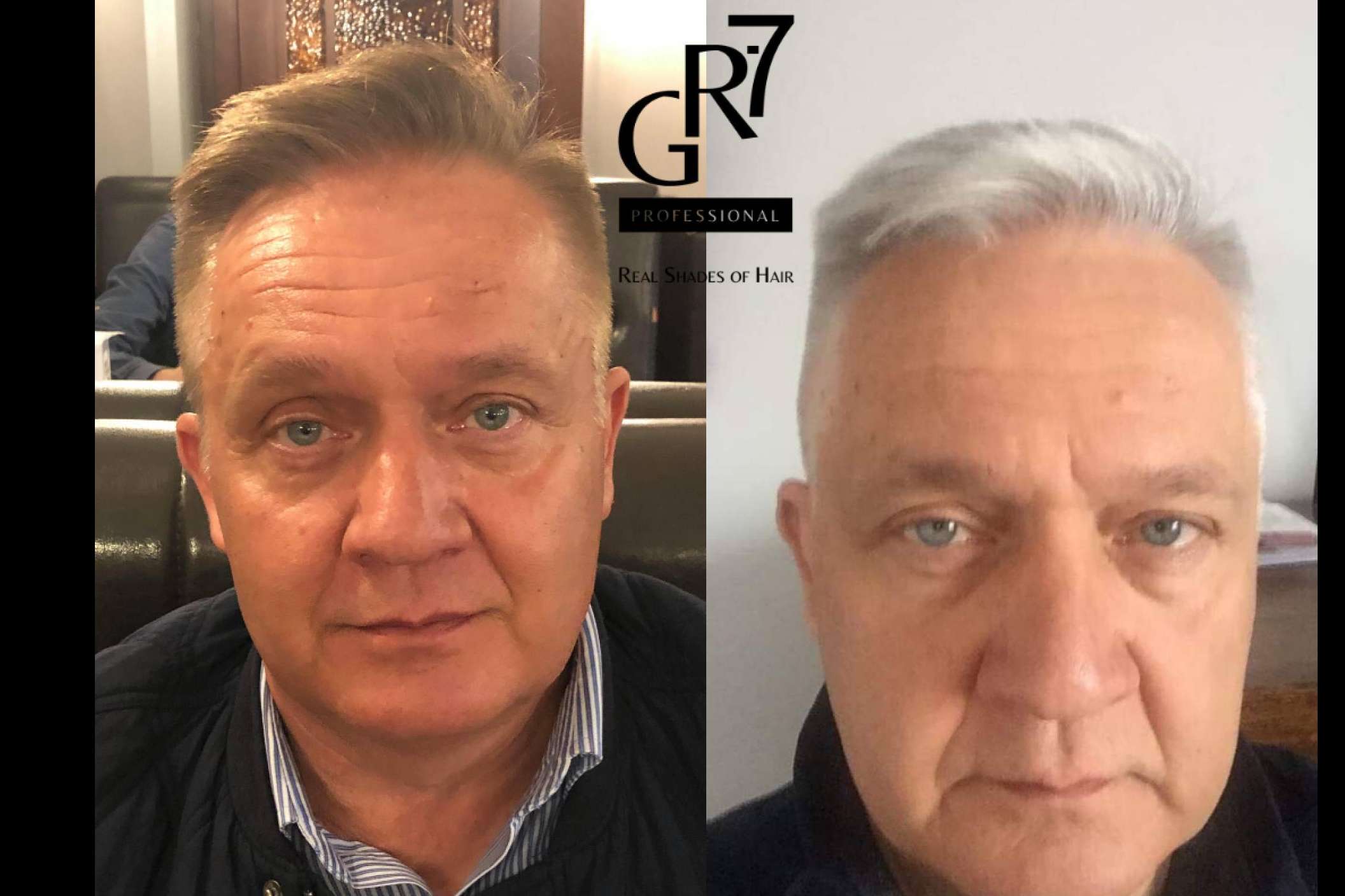 Revertir la aparición de canas y devolver el color natural al cabello con la loción GR-7 Professional