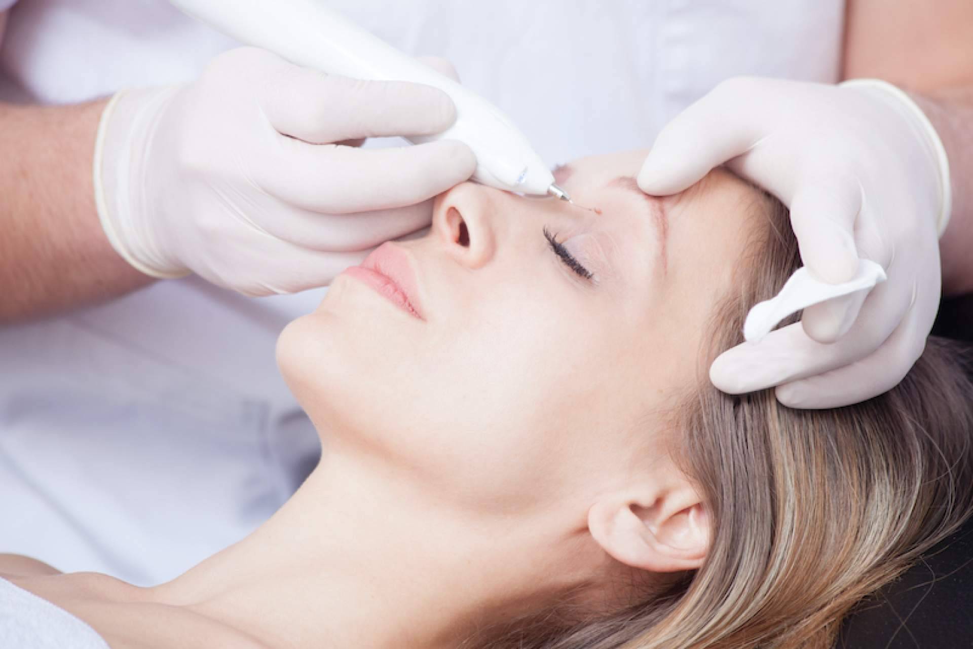 Eliminación de lunares y verrugas, con Centro Médico El Pilar